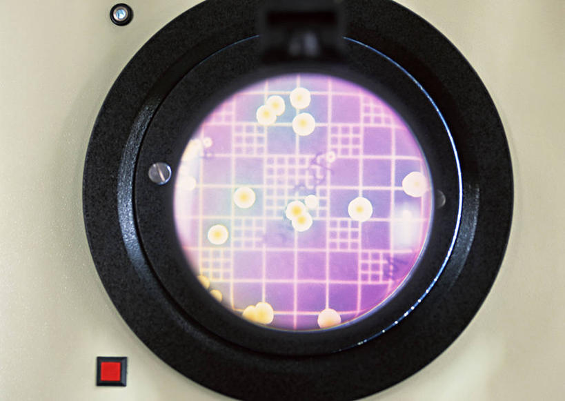 无人,横图,俯视,室内,特写,白天,实验,仪器,微生物,阴影,研究,反射,分析,化学,细菌,测试,培养皿,影子,紫色,器皿,生物,试验耗材,实验用品,化学器材,生命体,彩图,高角度拍摄,原核生物