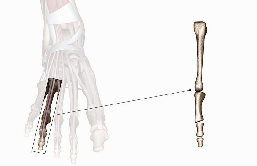 手,无名指,动脉,静脉,骨骼,关节,无人,横图,插画,室内,特写,白天,白色背景,正面,数码,科技,静物,阴影,网络,医学,骨头,高光,几何,计算机图形,合成,图画,方向,箭头,画,一个,黑色,模型,手部,人体,单个,电脑合成图,数码合成图,骨架,生物学,指向,漫画,生理学,写实,具体,具象,簇,腕骨,掌骨,趾骨,半身,彩图