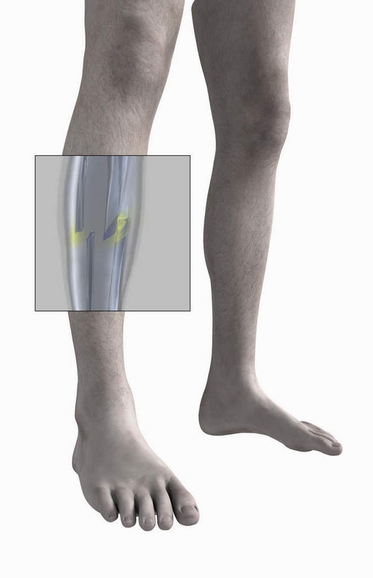 腿部,动脉,静脉,骨骼,肌肉,腿,健壮,无人,竖图,插画,室内,特写,白天,白色背景,正面,数码,科技,静物,阴影,网络,医学,骨头,高光,几何,计算机图形,合成,图画,光脚,画,模型,健康,赤脚,活力,力量,人体,青春,电脑合成图,数码合成图,骨架,生物学,强壮,漫画,生理学,写实,具体,具象,髌骨,腓骨,股骨,胫骨,半身,彩图