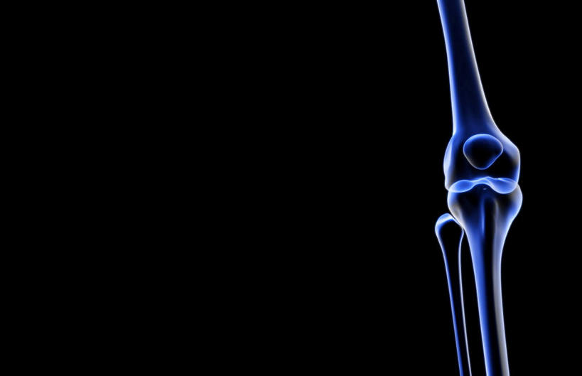 膝关节,无人,横图,插画,x光片,室内,白天,正面,数码,科技,一根,阴影,黑色背景,发光,辐射,科学,网络,医学,高光,几何,计算机图形,合成,图画,画,紫色,电脑合成图,数码合成图,医疗,科学技术,x射线,x光,漫画,写实,具体,具象,髌骨,彩图,电磁波,电磁辐射