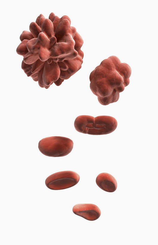 无人,竖图,插画,室内,特写,白天,白色背景,正面,数码,科技,静物,许多,阴影,网络,医学,细胞,高光,几何,计算机图形,球状,合成,图画,画,红色,血液,人体,电脑合成图,数码合成图,生物学,血细胞,漫画,白细胞,生理学,写实,具体,具象,红细胞,骨髓细胞,彩图