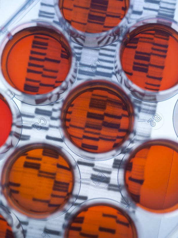 无人,竖图,俯视,室内,特写,白天,实验,仪器,水,一排,许多,阴影,蓝色背景,研究,整齐,并列,并排,反射,分析,科学,化学,基因,测试,圆形,培养皿,图形,液体,影子,圆,实验室,水滴,研究室,很多,几何,排列,橙色,器皿,生物,摄影,影棚,遗传,脱氧核糖核酸,队列,数学,平行,试验室,皮氏培养皿,试验耗材,实验用品,化学器材,DNA分子,去氧核糖核酸,遗传信息,遗传因子,遗传学,彩图,高角度拍摄,影棚拍摄,拍摄,几何图形,平面图形,DNA图谱,基因图,基因图谱