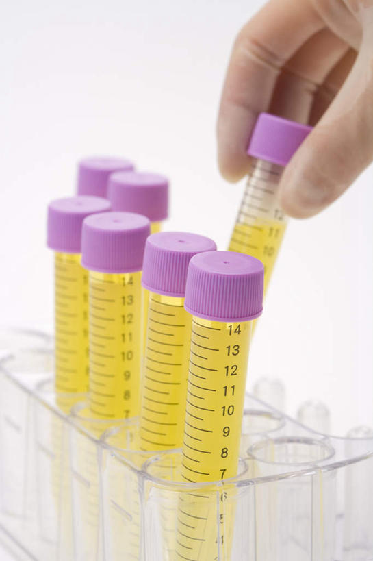 西方人,手,一个人,捏,竖图,俯视,室内,特写,白天,白色背景,安全,实验,仪器,桌面,桌子,杯子,欧洲,欧洲人,仅一个男性,仅一个人,一排,握,研究,整齐,透明,分析,科学,化学,测量,测试,木制,试管,试管架,刻度,防护,拿,捏着,拿着,注视,架子,玻璃制品,排列,仅一个年轻男性,一个,玻璃瓶,木制品,瓶子,手套,观察,看,手部,器皿,握着,摄影,影棚,单个,观看,保护,精密,科研,察看,队列,关注,精准,化验,保险,精细,检验,计量,玻璃仪器,试验耗材,实验用品,吸液管,量仪,保全,周全,安稳,安定,防护手套,平安,男人,男性,年轻男性,白种人,玻璃杯,半身,彩图,高角度拍摄,影棚拍摄,拍摄