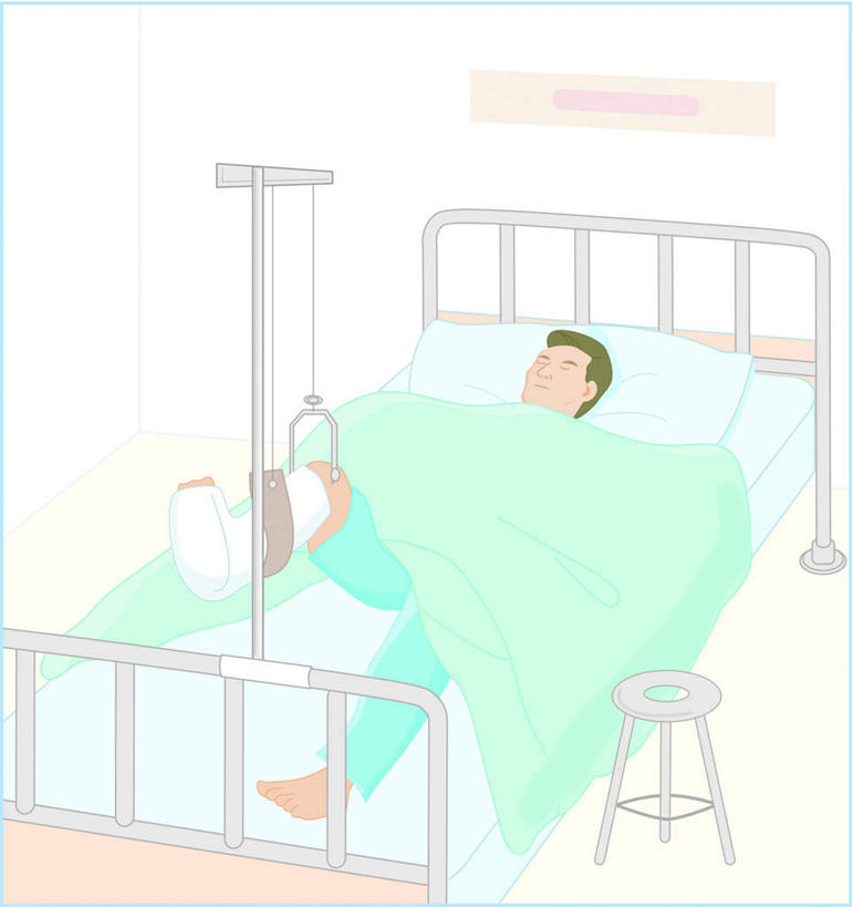 东方人,腿部,腿,一个人,无人,病人,躺,闭眼,竖图,俯视,插画,室内,白天,白色背景,工作服,制服,数码,科技,床,椅子,石膏,亚洲,仅一个男性,仅一个人,悬挂,阴影,网络,床单,高光,几何,计算机图形,合成,图画,黄种人,被子,画,仅一个年轻男性,单人床,电脑合成图,数码合成图,被单,漫画,绑带,写实,具体,具象,工作制服,卧着,男人,男性,年轻男性,亚洲人,患者,就医者,创可贴,熟石膏,闭眼睛,闭着眼,闭着眼睛,躺着,卧,彩图,高角度拍摄,全身,工作套服,护创胶布