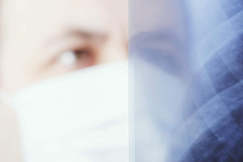 西方人,眼睛,眉毛,睫毛,一个人,医院,横图,x光片,室内,白天,正面,欧洲,欧洲人,瞳孔,仅一个男性,仅一个人,仅一个中年男性,一张,握,阴影,朦胧,模糊,分离,辐射,光线,科学,医学,影子,灯光,过滤,拿,分开,拿着,注视,一个,口罩,观察,看,隔断,握着,遮掩,眼部,单个,观看,隔离,察看,医疗,卫生,科学技术,x射线,掩盖,遮挡,关注,净化,间隔,预防,x光,遮盖,防尘,医疗机构,掩饰,断绝,隔开,屏蔽,屏绝,远离,中断,阻遏,阻隔,男人,男性,中年男性,白种人,睫,眉,眼,眼睫毛,眼眉,半身,彩图,病院,诊所,眼眉毛,电磁波,电磁辐射