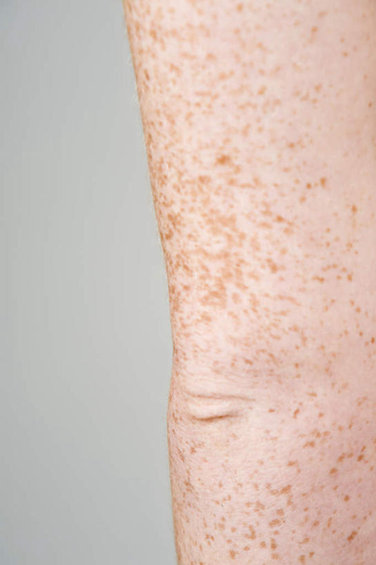 西方人,手,关节,一个人,竖图,室内,特写,白天,正面,欧洲,欧洲人,仅一个年轻女性,仅一个女性,仅一个人,灰色背景,斑点,手部,摄影,影棚,皮肤,雀斑,雀瘢,年轻女性,女人,女性,白种人,半身,彩图,影棚拍摄,拍摄