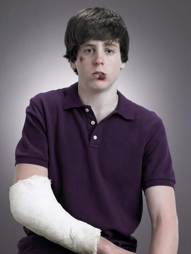 西方人,一个人,站,竖图,室内,白天,正面,石膏,欧洲,欧洲人,仅一个男性,仅一个人,阴影,灰色背景,服装,反射,影子,注视,休闲装,仅一个年轻男性,衣服,紫色,观察,看,站着,休闲,休闲服,摄影,服饰,影棚,观看,察看,关注,受伤,男人,男性,年轻男性,白种人,创可贴,熟石膏,站立,半身,彩图,影棚拍摄,拍摄,护创胶布