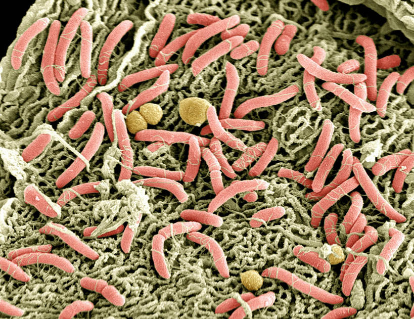 阴道,无人,横图,俯视,室内,特写,白天,仪器,微生物,检查,反射,分析,科学,细菌,显微镜,黄色,红色,观察,生物,清晰,探索,放大,观看,仔细,透镜,凸透镜,聚焦,关注,光学,清楚,生命体,显微图片,彩图,高角度拍摄,扫描电镜,扫描电子显微镜,原核生物