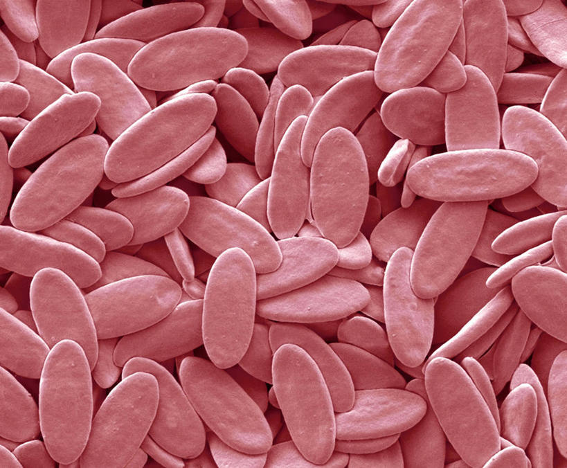 无人,横图,俯视,室内,特写,白天,仪器,微生物,许多,检查,反射,分析,科学,血球,医学,细胞,显微镜,很多,红色,观察,清晰,探索,放大,观看,仔细,透镜,生物学,血细胞,凸透镜,聚焦,关注,光学,清楚,显微图片,彩图,高角度拍摄,扫描电镜,扫描电子显微镜